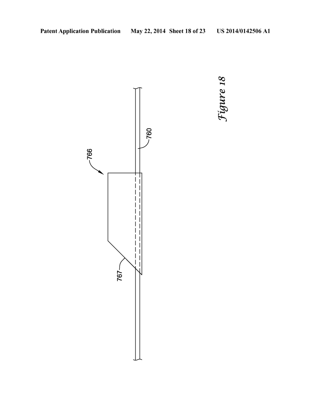 BALLOON CATHETER WITH IMPROVED PUSHABILITY - diagram, schematic, and image 19