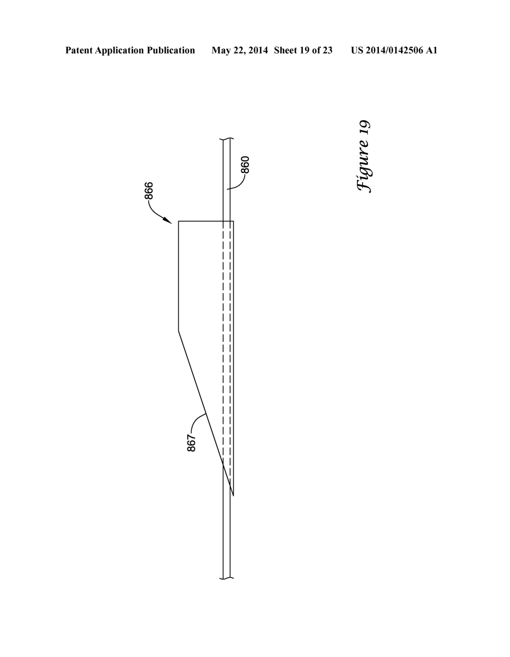 BALLOON CATHETER WITH IMPROVED PUSHABILITY - diagram, schematic, and image 20