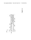 BALLOON CATHETER WITH IMPROVED PUSHABILITY diagram and image