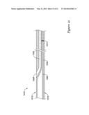 BALLOON CATHETER WITH IMPROVED PUSHABILITY diagram and image