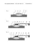 Method for vacuum therapy of wounds diagram and image