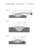 Method for vacuum therapy of wounds diagram and image