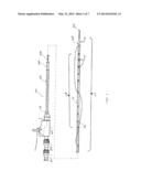 Catheter and Support Cannula Assembly diagram and image