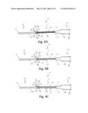 Low-Profile Intravenous Catheter Device diagram and image