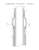 APPARATUS AND METHODS FOR RETRACTING A CATHETER BALLOON diagram and image