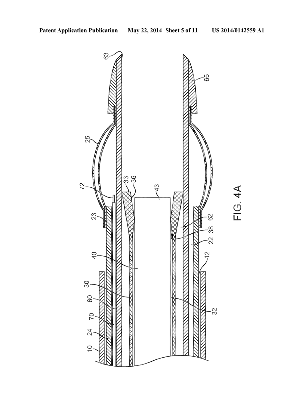 APPARATUS AND METHODS FOR RETRACTING A CATHETER BALLOON - diagram, schematic, and image 06