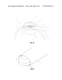 OPHTHALMIC SURGICAL DEVICE FOR CAPSULOTOMY diagram and image