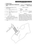 Apparatus and Method to Access Bone Marrow diagram and image