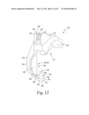 CUSTOMIZED PATIENT-SPECIFIC BONE CUTTING BLOCKS diagram and image