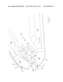 OCCLUSION CLIP diagram and image