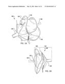 IMPLANTABLE MEDICAL DEVICE DEPLOYMENT SYSTEM diagram and image