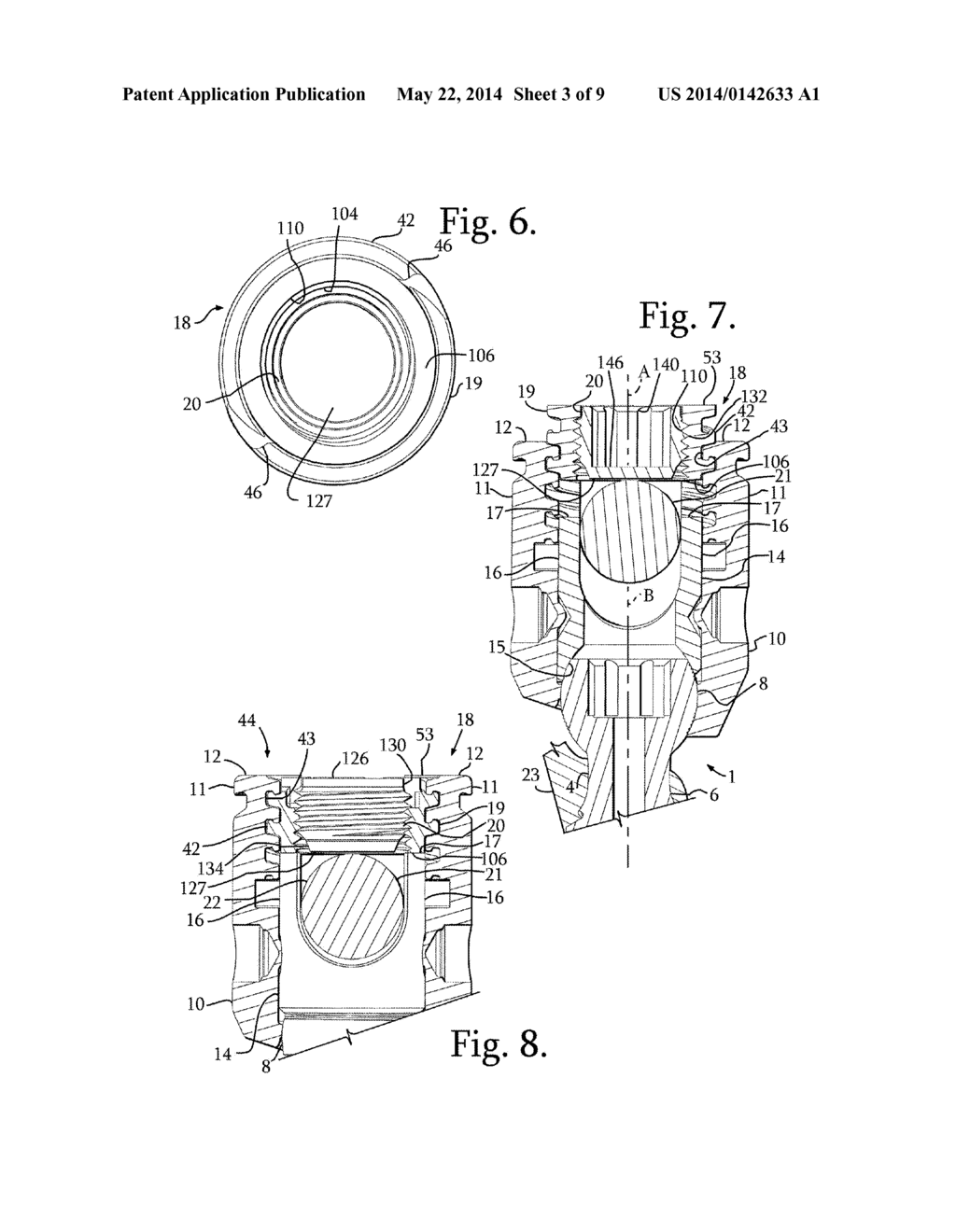 SPLAY CONTROL CLOSURE FOR OPEN BONE ANCHOR - diagram, schematic, and image 04