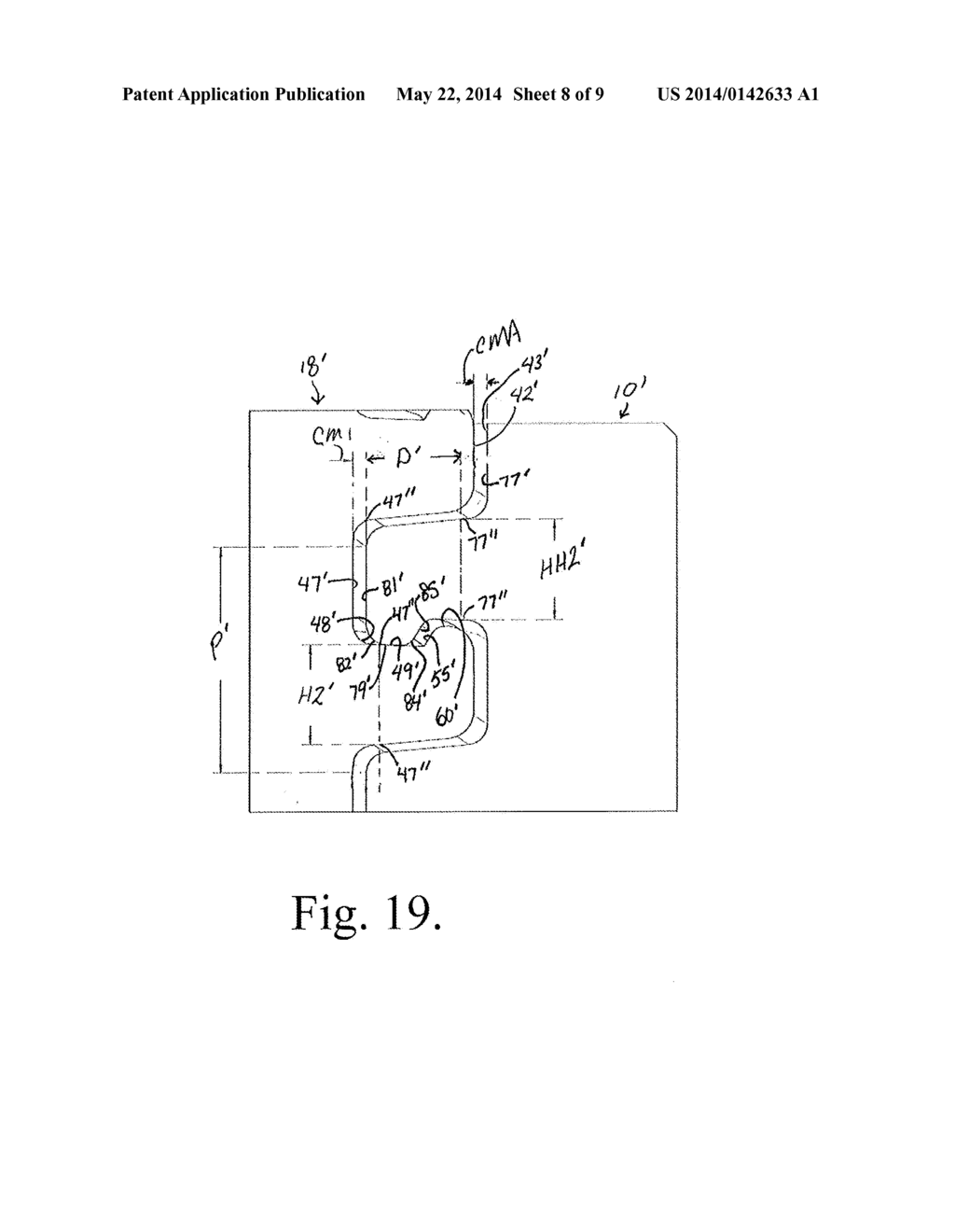 SPLAY CONTROL CLOSURE FOR OPEN BONE ANCHOR - diagram, schematic, and image 09