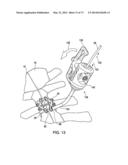 BONE PLATE SYSTEM AND METHOD diagram and image