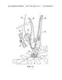 BONE PLATE SYSTEM AND METHOD diagram and image