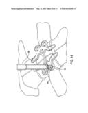 BONE PLATE SYSTEM AND METHOD diagram and image