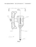 BONE PLATE SYSTEM AND METHOD diagram and image