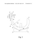 KNEE PROSTHESIS ASSEMBLY HAVING PROPORTIONAL TROCHLEAR GROOVE GEOMETRY diagram and image