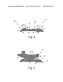 KNEE PROSTHESIS ASSEMBLY HAVING PROPORTIONAL TROCHLEAR GROOVE GEOMETRY diagram and image