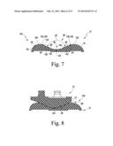 KNEE PROSTHESIS ASSEMBLY HAVING PROPORTIONAL TROCHLEAR GROOVE GEOMETRY diagram and image