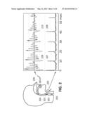 SYSTEM AND METHOD FOR VOICE TRANSFORMATION diagram and image