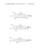 Orthodontic Toothbrush diagram and image