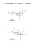 TRANSMISSION LEVEL GAUGE AND PROCESS FOR TRANSMISSIONS WITHOUT DIPSTICK diagram and image