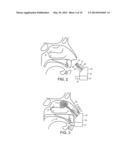 NASAL ADMINISTRATION diagram and image