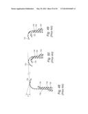 CUSHION FOR PATIENT INTERFACE diagram and image