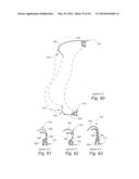 CUSHION FOR PATIENT INTERFACE diagram and image