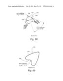 CUSHION FOR PATIENT INTERFACE diagram and image