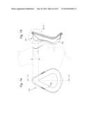 CUSHION FOR PATIENT INTERFACE diagram and image