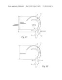 CUSHION FOR PATIENT INTERFACE diagram and image