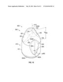 APPARATUS AND METHOD FOR RETAINING INSERTS OF A ROLLING CONE DRILL BIT diagram and image