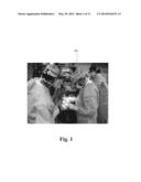 WIRELESS SURGICAL LOUPE diagram and image