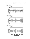 DIRECT ECHO PARTICLE IMAGE VELOCIMETRY FLOW VECTOR MAPPING ON ULTRASOUND     DICOM IMAGES diagram and image