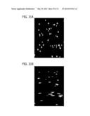 DIRECT ECHO PARTICLE IMAGE VELOCIMETRY FLOW VECTOR MAPPING ON ULTRASOUND     DICOM IMAGES diagram and image