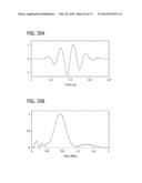 DIRECT ECHO PARTICLE IMAGE VELOCIMETRY FLOW VECTOR MAPPING ON ULTRASOUND     DICOM IMAGES diagram and image