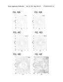 DIRECT ECHO PARTICLE IMAGE VELOCIMETRY FLOW VECTOR MAPPING ON ULTRASOUND     DICOM IMAGES diagram and image