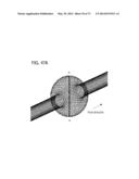 DIRECT ECHO PARTICLE IMAGE VELOCIMETRY FLOW VECTOR MAPPING ON ULTRASOUND     DICOM IMAGES diagram and image