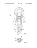 DENTAL IMPLANT diagram and image