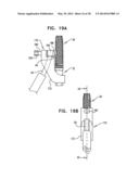 DENTAL IMPLANTS, TOOLS, AND METHODS diagram and image