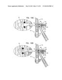 DENTAL IMPLANTS, TOOLS, AND METHODS diagram and image