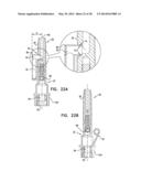 DENTAL IMPLANTS, TOOLS, AND METHODS diagram and image