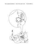 DENTAL IMPLANTS, TOOLS, AND METHODS diagram and image