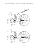 DENTAL IMPLANTS, TOOLS, AND METHODS diagram and image