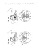 DENTAL IMPLANTS, TOOLS, AND METHODS diagram and image