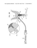 DENTAL IMPLANTS, TOOLS, AND METHODS diagram and image