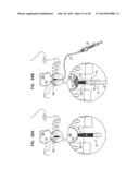 DENTAL IMPLANTS, TOOLS, AND METHODS diagram and image