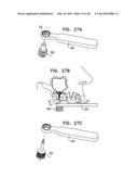 DENTAL IMPLANTS, TOOLS, AND METHODS diagram and image